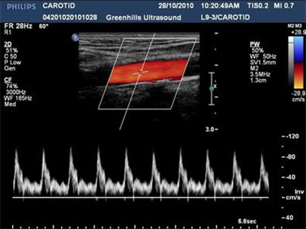 Ultrasound – GXU Medical Imaging