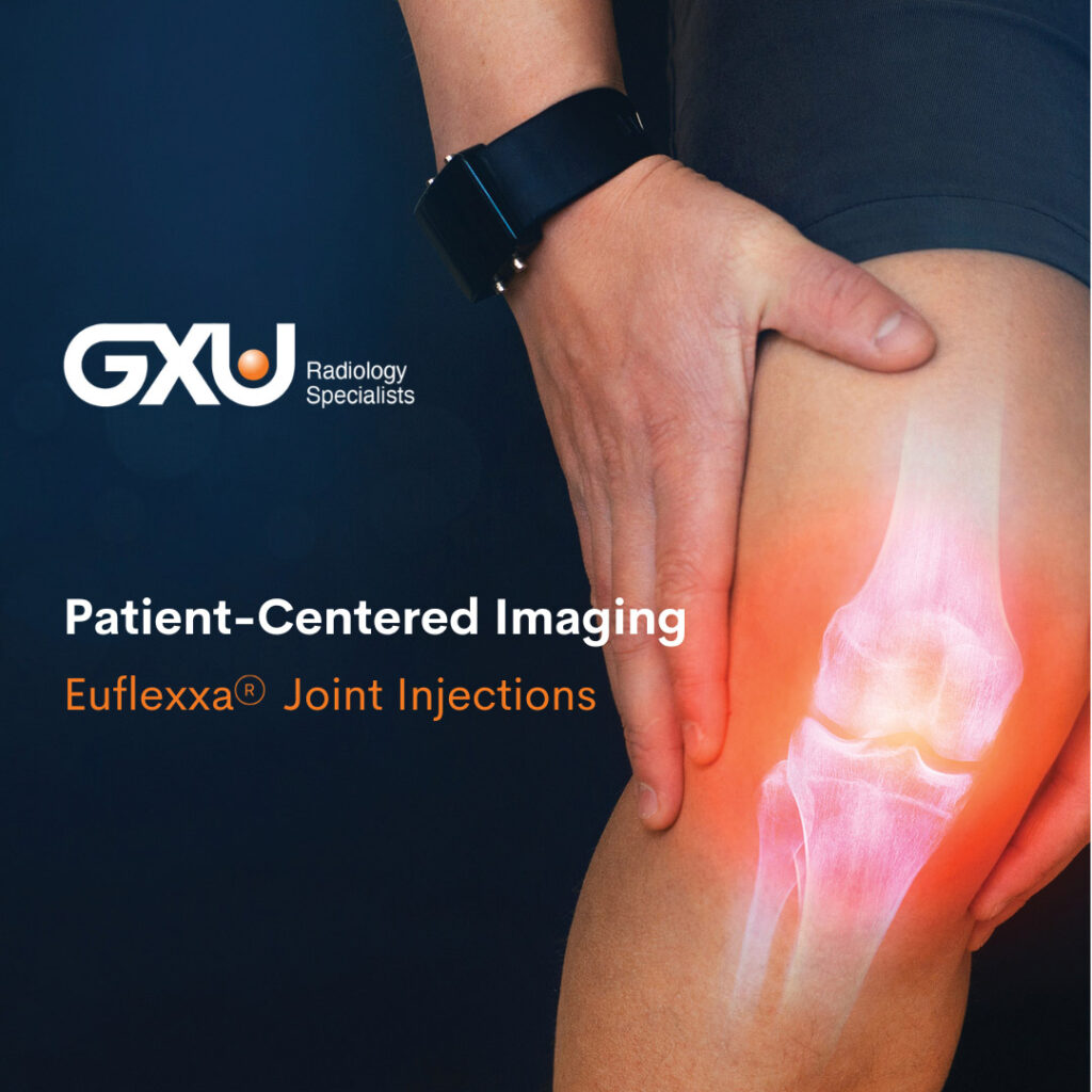 Euflexxa joint injections